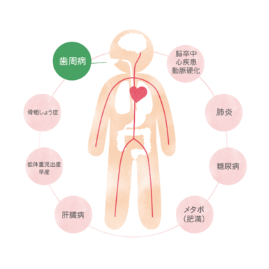 口内フローラを整え虫歯を撃退！「腸内フローラ」の善玉菌増加に有効な歯磨き粉