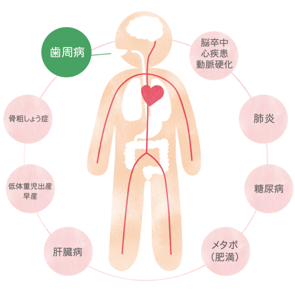 口内フローラを整え虫歯を撃退！「腸内フローラ」の善玉菌増加に有効な歯磨き粉