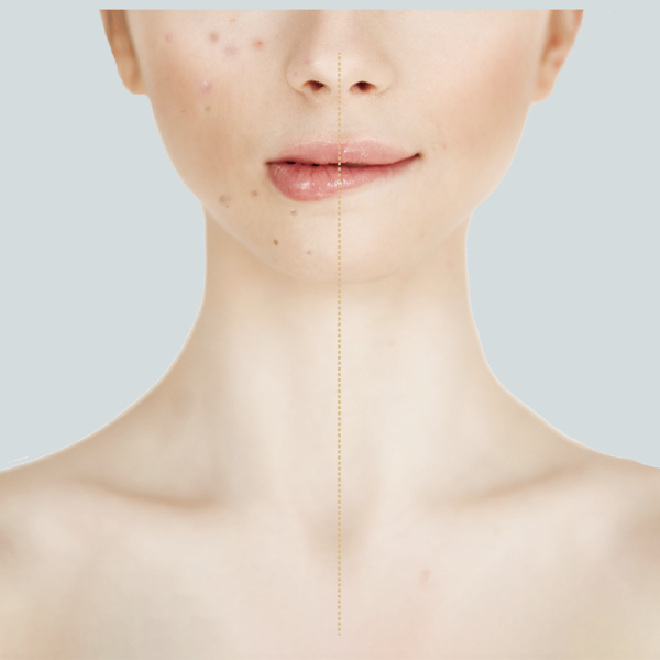 便秘解消することで得られる３つのこと。「美容」「健康」「ストレス緩和」」